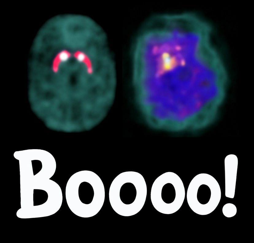 Happy Brain